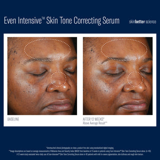 Even Tone Intensive Correcting Serum