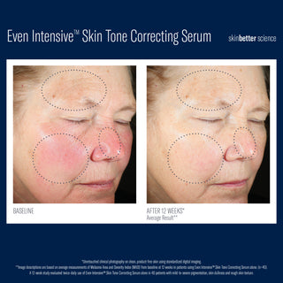 Even Tone Intensive Correcting Serum