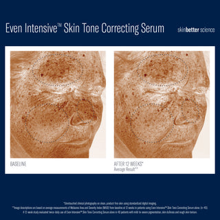 Even Tone Intensive Correcting Serum