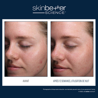 AlphaRet® Clearing Serum
