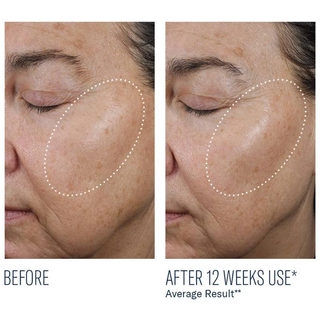 AMPRA® Volumizing Macro HA Serum