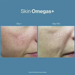 Skin Omegas+