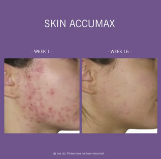 Skin Accumax®