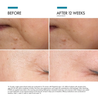 P-TIOX Serum
