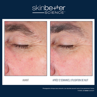 EyeMax AlphaRet® Overnight Cream