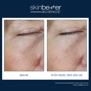 Instant Effect Gel EYE